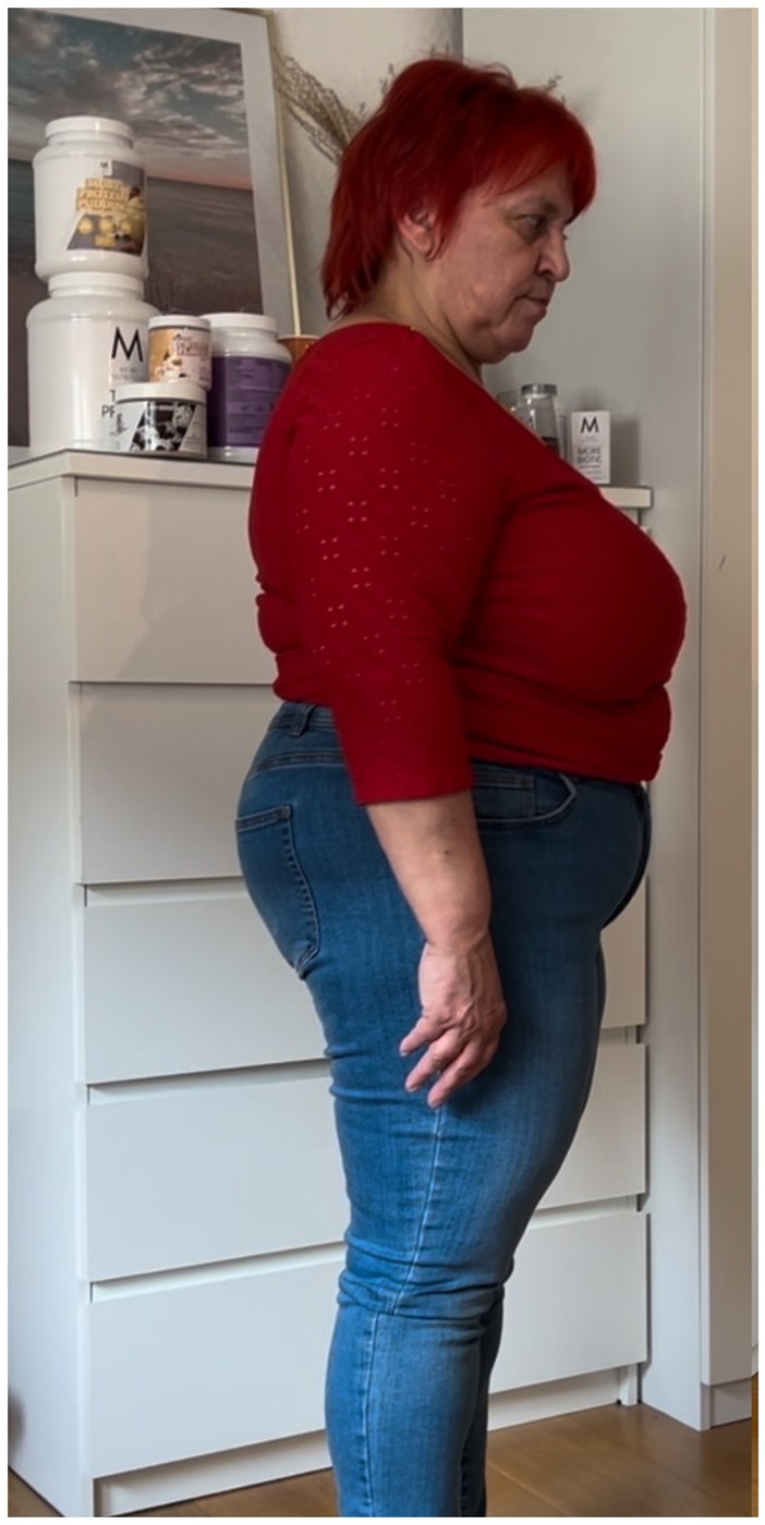 Selis Mama vorher